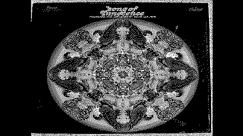 Thumbnail for breaks